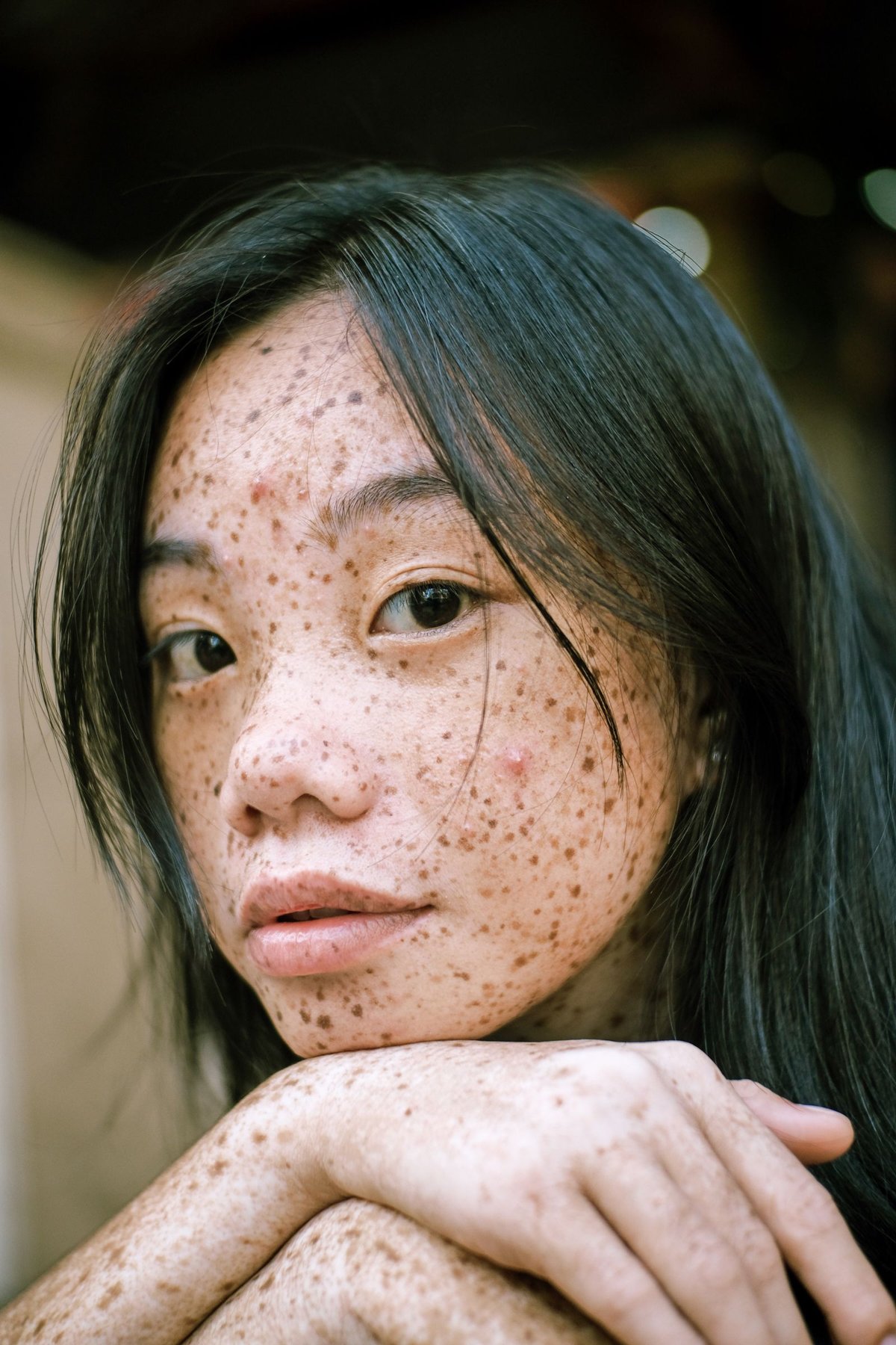 Portrait showing freckles and skin texture.